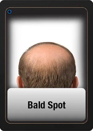 Bald Spot